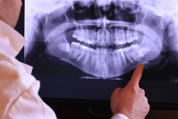 Best Weekend Emergency Dental Services in Monticello, IN