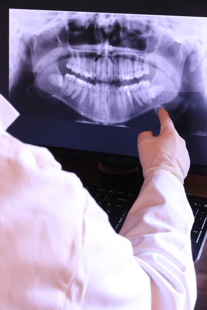 Best Knocked-Out Tooth (Avulsed Tooth) Treatment in Monticello, IN