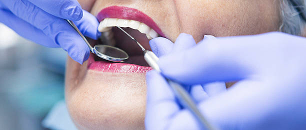 Best Emergency Treatment for Oral Infections in Monticello, IN
